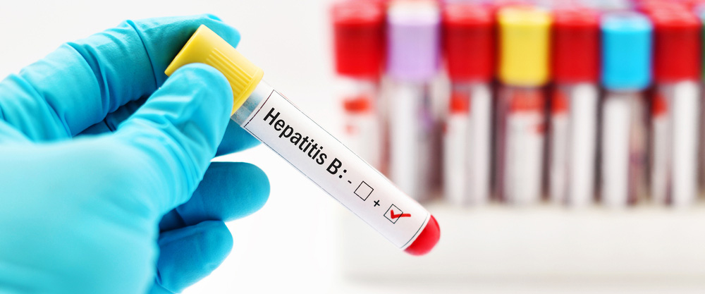 What is Hepatitis B? What are the symptoms and treatment methods?